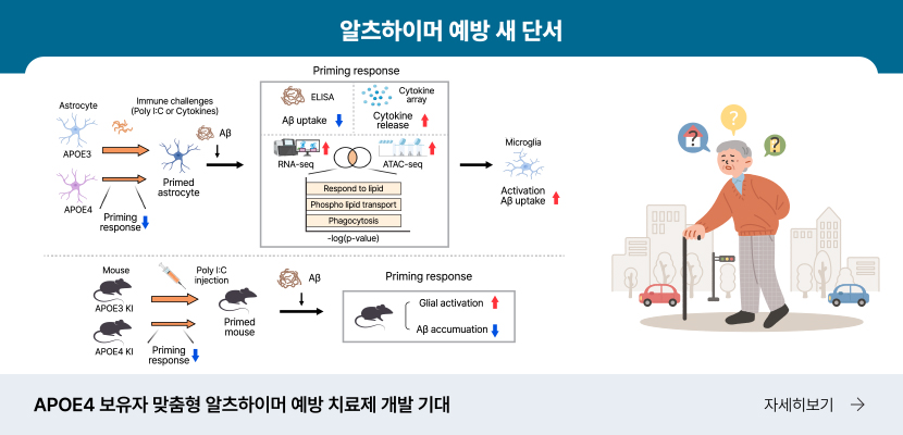 알츠하이머 예방 새 단서